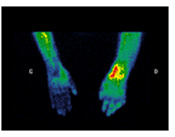 image radiologique montrant une scintigraphie osseuse