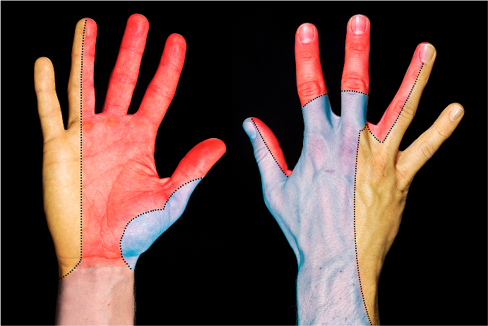 A Patient's Guide to Cubital Tunnel Syndrome - Hand and Upper Limb